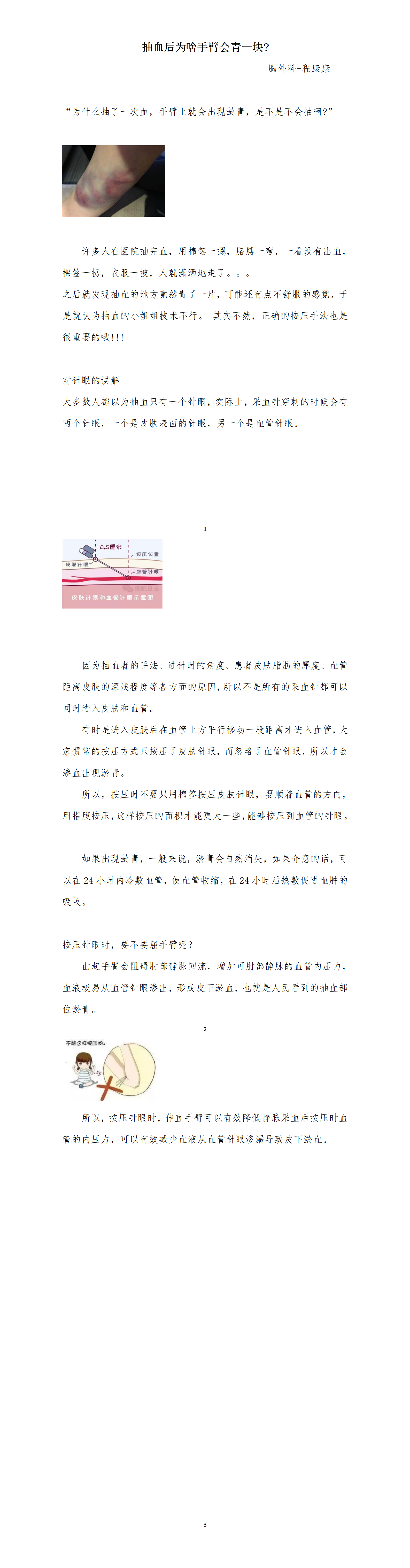 胸外科普文章2_01.png