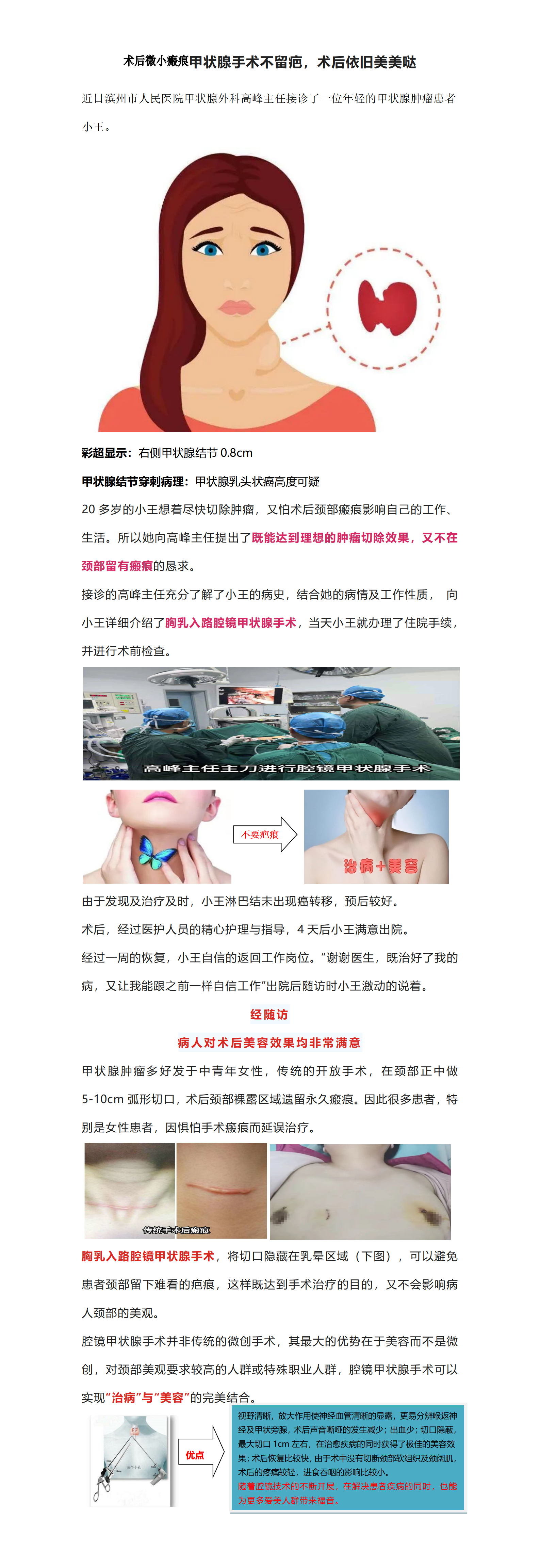 腔镜甲状腺手术之美容篇_01.png