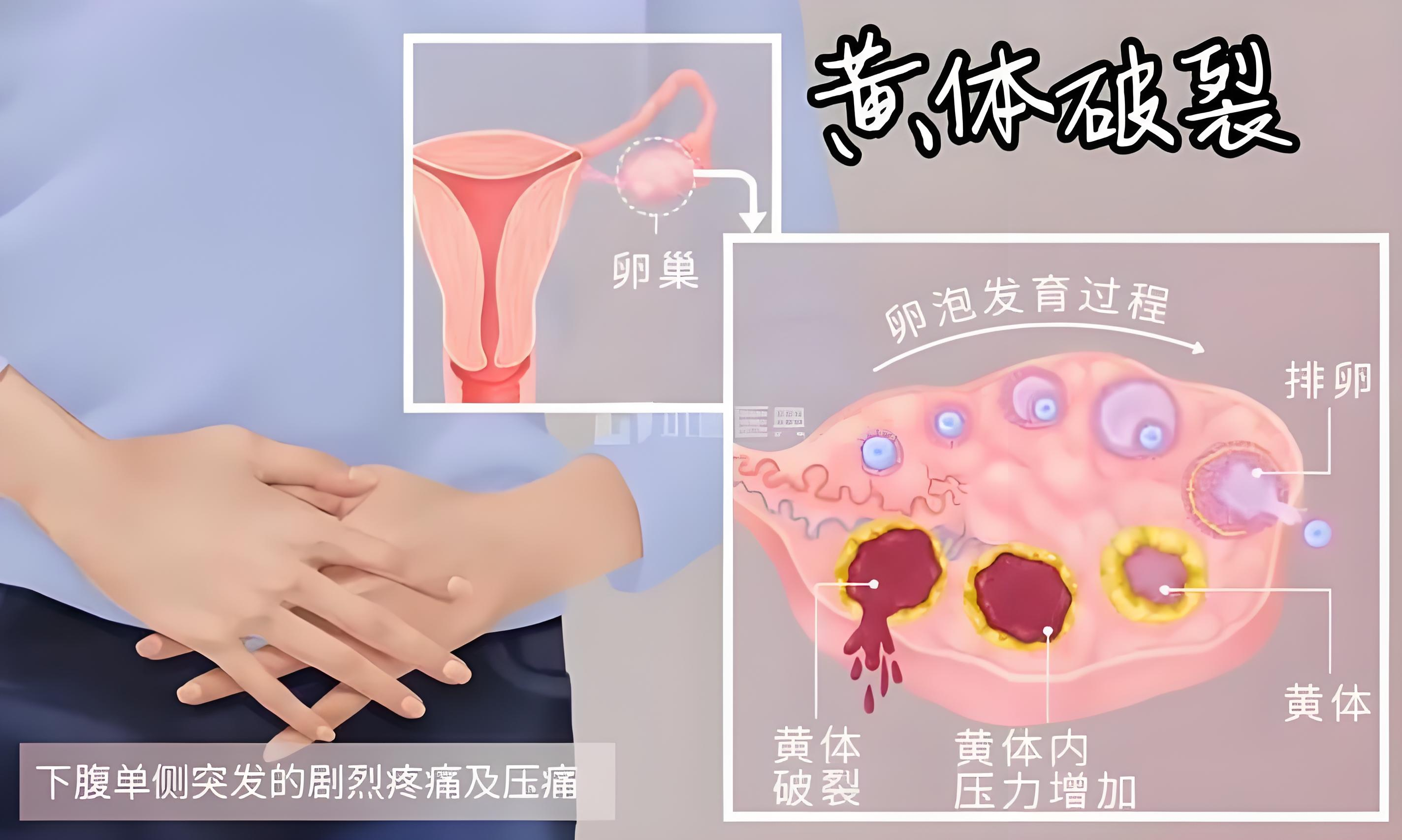 图片 2.png