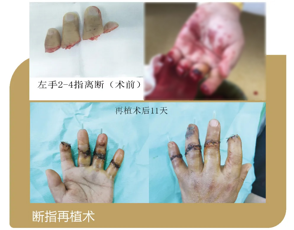 86e8807f1bbc4256aebc85232a0c9429~tplv-obj.jpg